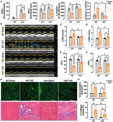 Cardioprotective Effects of n-3 Polyunsaturated Fatty Acids: Orchestration of mRNA Expression, Protein Phosphorylation, and Lipid Metabolism in Pressure Overload Hearts